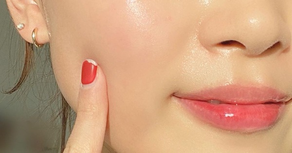 Loạt Tuyệt Chiêu Giúp Chị Em Chăm Sóc Da Mụn Đúng Cách