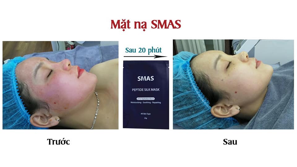 Mặt Nạ Dưỡng Và Phục Hồi Da SMAS Peptide Silk Mask Nhật Bản - Dr. Roller Vietnam